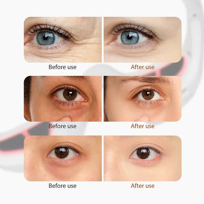 Rovio™ VisioSculpt - 2 in 1 Red Light Therapy + EMS For Eyebags Erasing